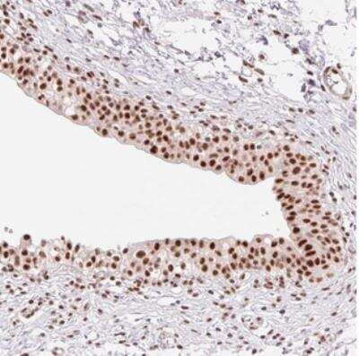 Immunohistochemistry: PRDM11 Antibody [NBP2-30650]