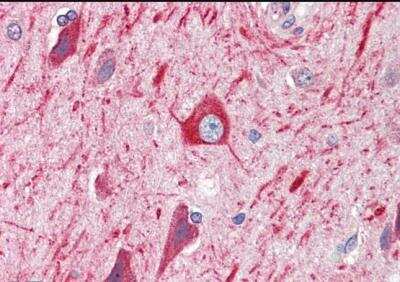 Immunohistochemistry-Paraffin: PRDM11 Antibody [NB100-1525]