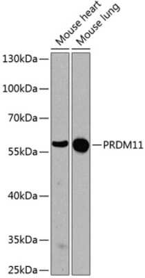 Western Blot: PRDM11 AntibodyBSA Free [NBP2-94711]