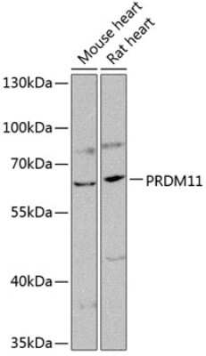 Western Blot: PRDM11 AntibodyBSA Free [NBP2-94840]