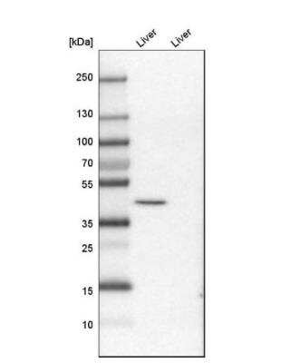 Western Blot: PRDM12 Antibody [NBP1-85829]