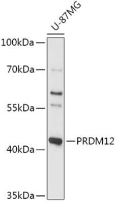 Western Blot: PRDM12 AntibodyAzide and BSA Free [NBP2-94252]