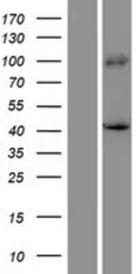 Western Blot: PRDM12 Overexpression Lysate [NBP2-06529]