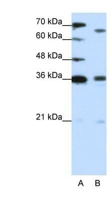 Western Blot: PRDM13 Antibody [NBP1-80361]