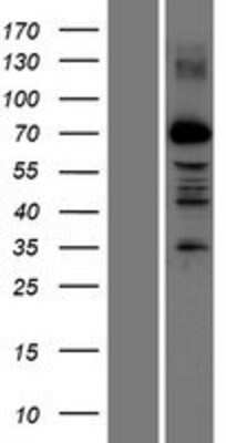 Western Blot: PRDM13 Overexpression Lysate [NBP2-06530]