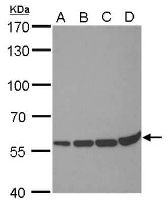 Western Blot: PRDM14 Antibody (1359) [NBP2-43593]