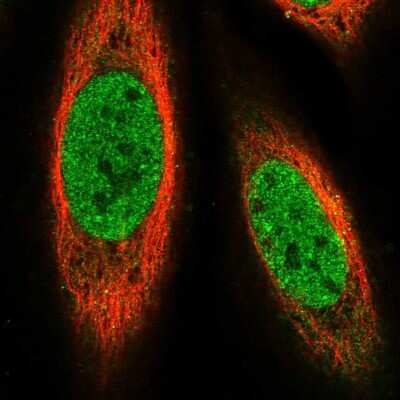 Immunocytochemistry/ Immunofluorescence: PRDM14 Antibody [NBP2-55342]