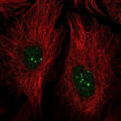 Immunocytochemistry/ Immunofluorescence: PRDM15 Antibody [NBP2-58474]