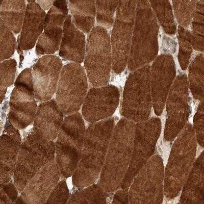 Immunohistochemistry-Paraffin: PRDM15 Antibody [NBP1-86816]