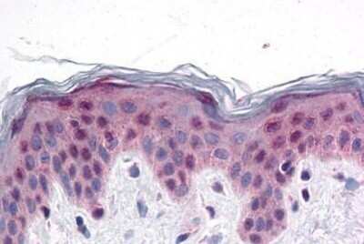 Immunohistochemistry-Paraffin: PRDM16/MEL1 Antibody - BSA Free [NBP1-71992]