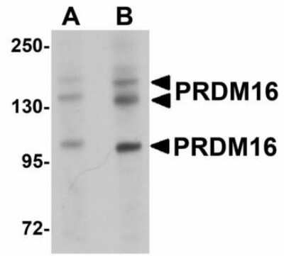 Western Blot: PRDM16/MEL1 AntibodyBSA Free [NBP1-71992]