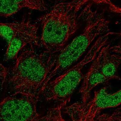 Immunocytochemistry/ Immunofluorescence: PRDM16/MEL1 Antibody [NBP2-58350]