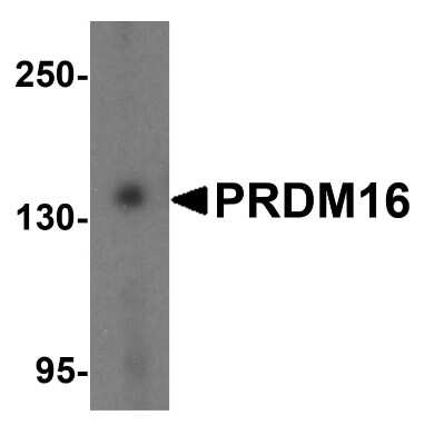 Western Blot: PRDM16/MEL1 AntibodyBSA Free [NBP1-77096]