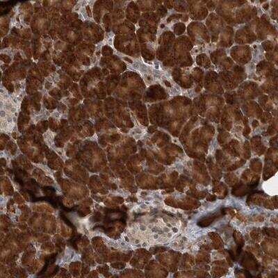 Immunohistochemistry: PRDM4 Antibody [NBP1-80921]