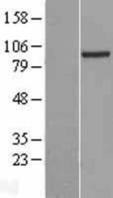 Western Blot: PRDM4 Overexpression Lysate [NBL1-14736]