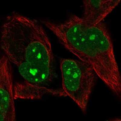 Immunocytochemistry/ Immunofluorescence: PRDM5 Antibody [NBP2-13810]