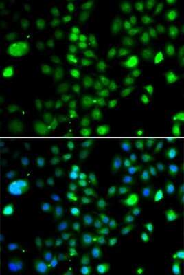 Immunocytochemistry/ Immunofluorescence: PRDM5 Antibody - BSA Free [NBP2-93069]