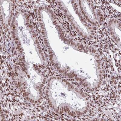 Immunohistochemistry-Paraffin: PRDM5 Antibody [NBP2-13810]
