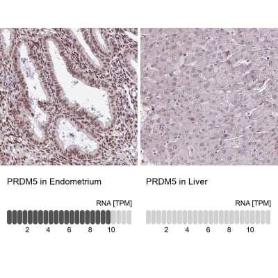 Immunohistochemistry-Paraffin: PRDM5 Antibody [NBP2-13810]