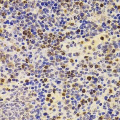 Immunohistochemistry-Paraffin: PRDM5 Antibody - BSA Free [NBP2-93069]