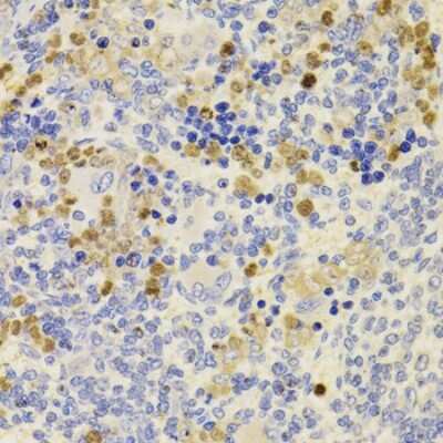 Immunohistochemistry-Paraffin: PRDM5 Antibody - BSA Free [NBP2-93069]