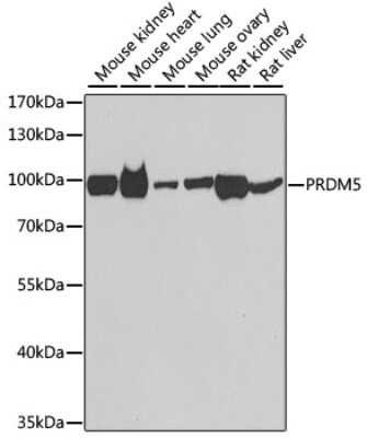 Western Blot: PRDM5 AntibodyBSA Free [NBP2-93069]