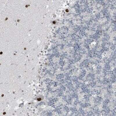 Immunohistochemistry-Paraffin: PRDM6 Antibody [NBP1-91022]