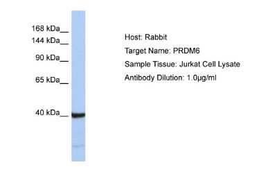 Western Blot: PRDM6 Antibody [NBP2-83416]