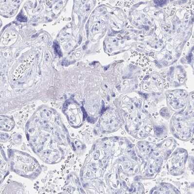 Immunohistochemistry-Paraffin: PRDM7 Antibody [NBP2-32504]