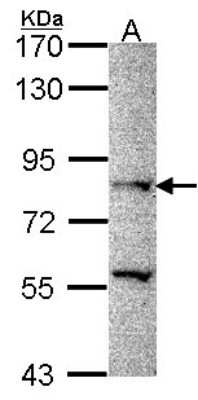 Western Blot: PRDM8 Antibody [NBP1-33646]