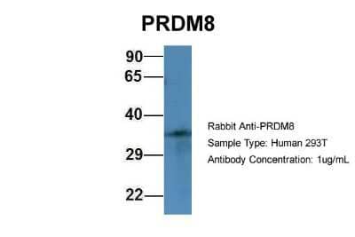 Western Blot: PRDM8 Antibody [NBP2-85533]