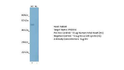 Western Blot: PRDM8 Antibody [NBP2-85533]