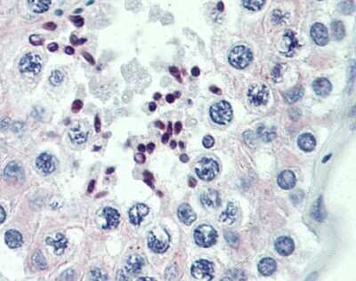 Immunohistochemistry: PRDM9 Antibody [NBP1-80118]