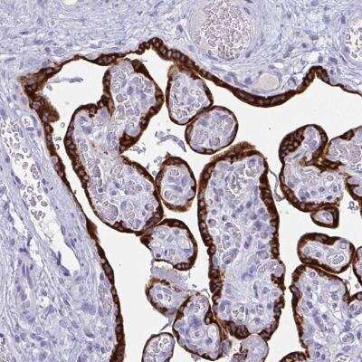 Immunohistochemistry-Paraffin: PRDM9 Antibody [NBP2-32478]