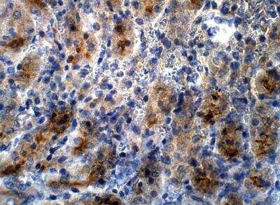 Immunohistochemistry-Paraffin: PRDM9 Antibody [NBP3-12335]