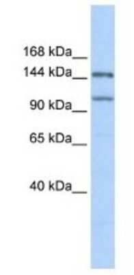 Western Blot: PRDM9 Antibody [NBP1-80118]