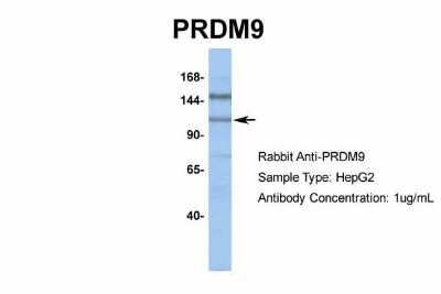 Western Blot: PRDM9 Antibody [NBP1-80118]