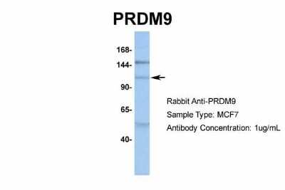 Western Blot: PRDM9 Antibody [NBP1-80118]