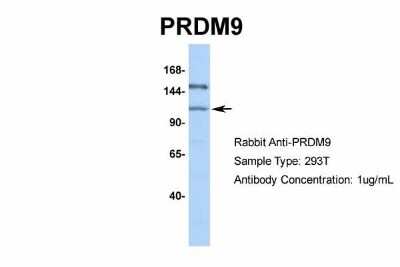 Western Blot: PRDM9 Antibody [NBP1-80118]