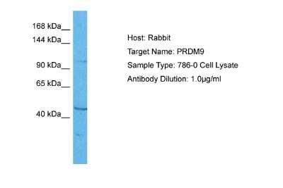 Western Blot: PRDM9 Antibody [NBP1-80118]