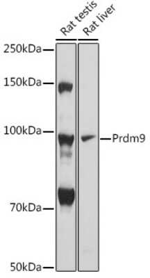 Western Blot: PRDM9 AntibodyAzide and BSA Free [NBP3-16014]