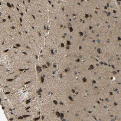 Immunohistochemistry-Paraffin: PREB Antibody [NBP1-87056]