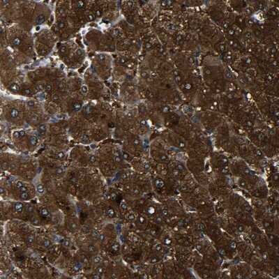 Immunohistochemistry-Paraffin: PREB Antibody [NBP1-87057]