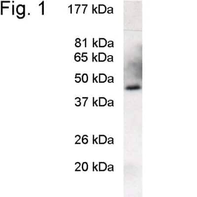 Western Blot: PREB Antibody [NB120-3422]