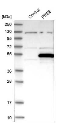 Western Blot: PREB Antibody [NBP1-87056]