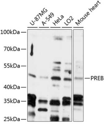 Western Blot: PREB AntibodyAzide and BSA Free [NBP3-04673]