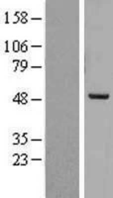 Western Blot: PREB Overexpression Lysate [NBL1-14744]