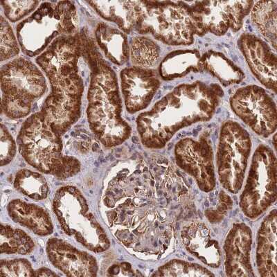 Immunohistochemistry-Paraffin: PRED31 Antibody [NBP2-14420]
