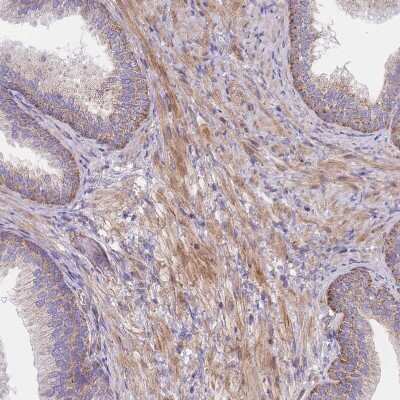 Immunohistochemistry-Paraffin: PRED31 Antibody [NBP2-14420]