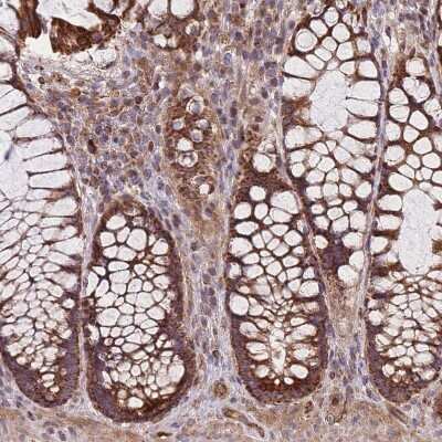 Immunohistochemistry-Paraffin: PRED31 Antibody [NBP2-14420]